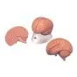Classic brain C15